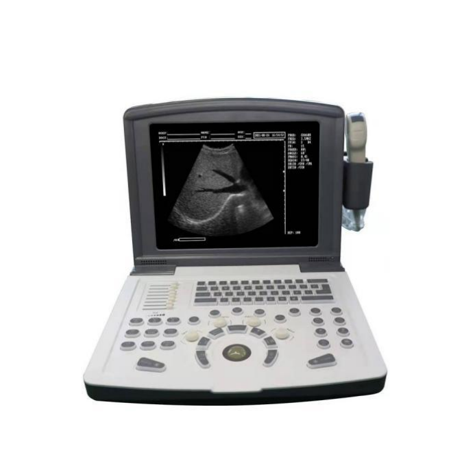 Full Digital Ultrasound Scanner